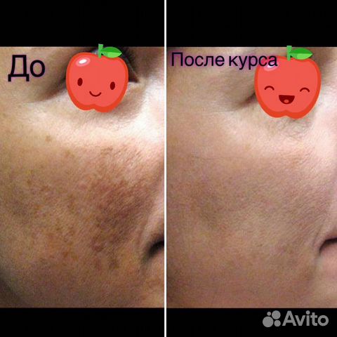 Косметолог-эстетист/ламинирование бровей/ресниц/чи